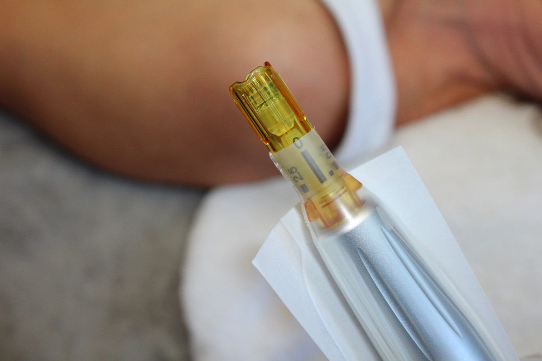 How Often Replace Microneedling Cartridges?